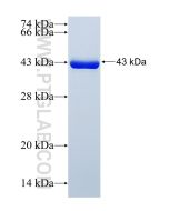 Recombinant human RNF160 protein Ag29471 proteintech