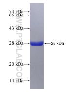 Recombinant human TRIM59 protein Ag29572 proteintech