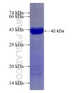 Recombinant human ANKRD1 protein Ag29974 proteintech