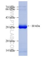 Recombinant human CR1 protein Ag30268 proteintech