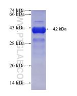 Recombinant human TRMT10C protein Ag30642 proteintech