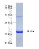 Recombinant human DCN protein Ag30859 proteintech
