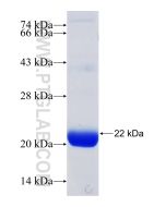 Recombinant human ATAT1 protein Ag31018 proteintech