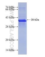 Recombinant human RPS23 protein Ag31190 proteintech