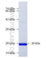 Recombinant human HTRA1 protein Ag31204 proteintech