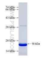 Recombinant human NDUFA9 protein Ag31239 proteintech