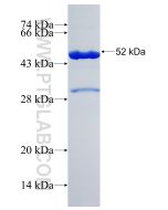 Recombinant human CHD8 protein Ag31425 proteintech