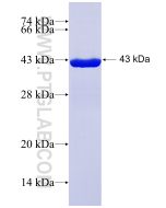 Recombinant human PDIA5 protein Ag31479 proteintech