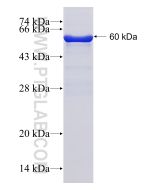 Recombinant human COL9A1 protein Ag3189 proteintech