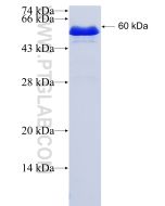Recombinant human HNF1B protein Ag3232 proteintech