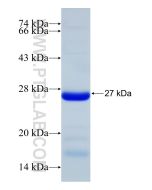 Recombinant human MYO5B protein Ag32670 proteintech