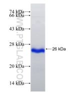 Recombinant human SMAD6 protein Ag32920 proteintech