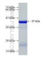 Recombinant human ODF2 protein Ag33139 proteintech