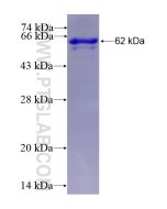 Recombinant human ENPP5 protein Ag3478 proteintech