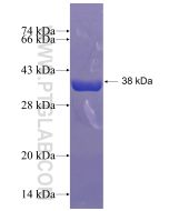 Recombinant human PFN4 protein Ag3538 proteintech