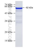 Recombinant human NOD1 protein Ag3697 proteintech