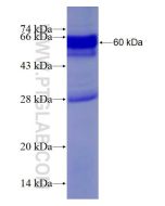 Recombinant human LDLRAP1 protein Ag4006 proteintech