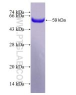 Recombinant human IL-16 protein Ag4044 proteintech