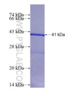 Recombinant human HSD17B3 protein Ag4081 proteintech