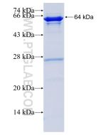 Recombinant human CYP51A1 protein Ag4235 proteintech