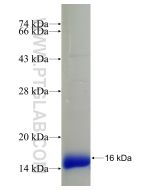 Recombinant human MBTPS2 protein Ag4390 proteintech