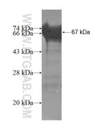 Recombinant human TXNDC3 protein Ag4514 proteintech