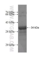 Recombinant human B3GALT4 protein Ag4603 proteintech