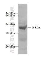 Recombinant human GTPBP4 protein Ag4701 proteintech