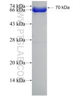 Recombinant human TRAK2 protein Ag4753 proteintech