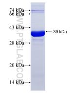 Recombinant human RDX protein Ag5000 proteintech
