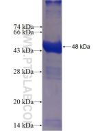 Recombinant human CNKSR3 protein Ag5244 proteintech