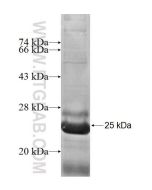Recombinant human NDUFAF2 protein Ag5304 proteintech