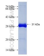 Recombinant human SOCS3 protein Ag5386 proteintech