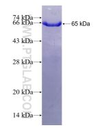 Recombinant human MPI protein Ag5475 proteintech