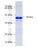 Recombinant human IKZF3 protein Ag5537 proteintech