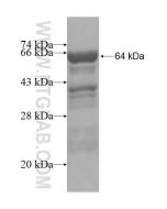 Recombinant human CTNNA2 protein Ag5747 proteintech