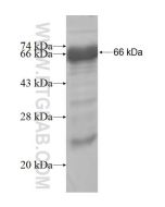 Recombinant human TIMELESS protein Ag5767 proteintech