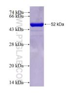 Recombinant human GSTA1 protein Ag5849 proteintech