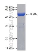 Recombinant human GSTM5 protein Ag5958 proteintech