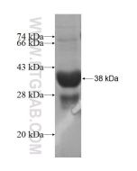 Recombinant human NRARP protein Ag6114 proteintech