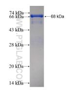Recombinant human TMPO protein Ag6247 proteintech