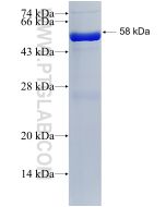 Recombinant human ATP6V1B1 protein Ag6332 proteintech