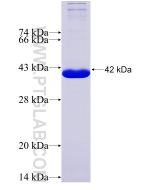 Recombinant human NOD1 protein Ag6567 proteintech