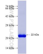 Recombinant human CLEC4D protein Ag6852 proteintech