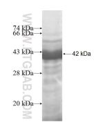 Recombinant human AARSD1 protein Ag7014 proteintech