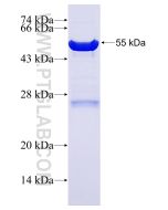 Recombinant human NDUFS3 protein Ag7072 proteintech