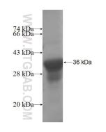Recombinant human TRMT1 protein Ag7112 proteintech