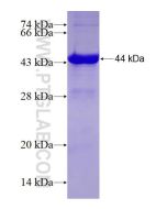 Recombinant human NDUFAF1 protein Ag7224 proteintech