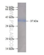 Recombinant human HCCS protein Ag7322 proteintech