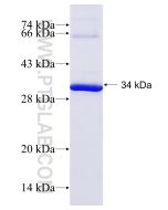 Recombinant human CAMK2D protein Ag7323 proteintech